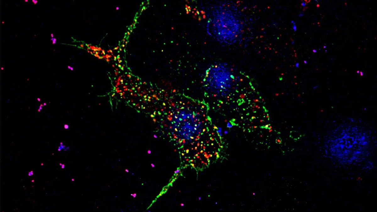Unclogging the Glucose Highways: A New Look at Type 2 Diabetes